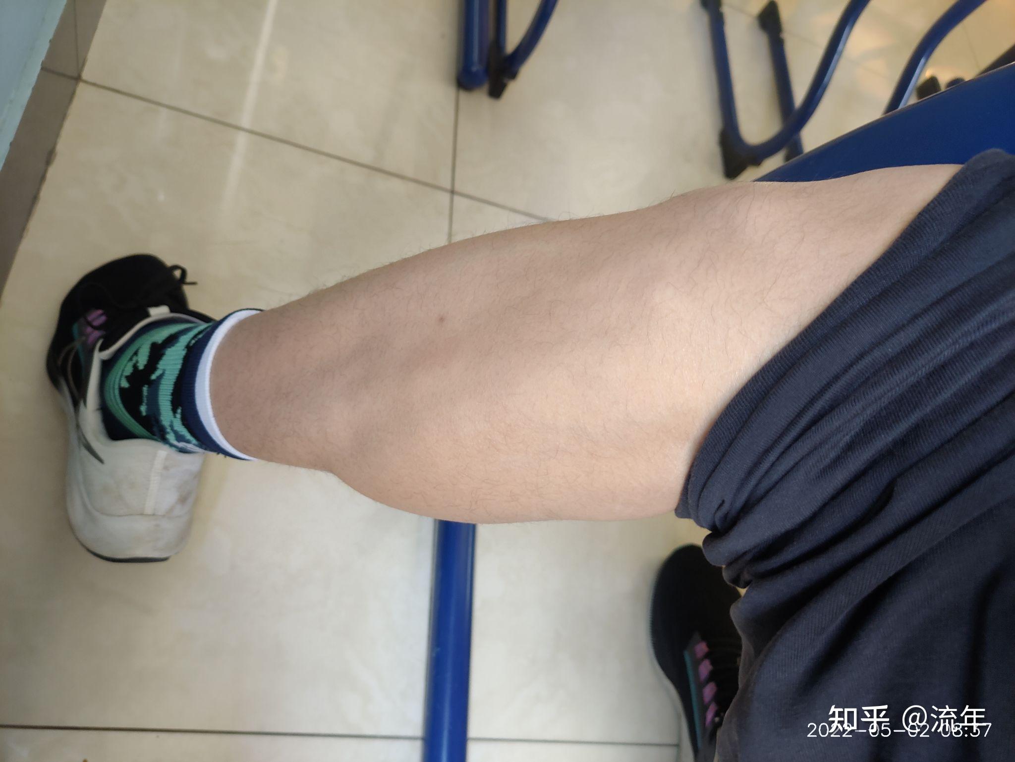 这样的小腿肌肉有什么影响吗