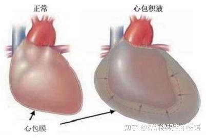 心骄元液刷糙析设胞确？(图1)