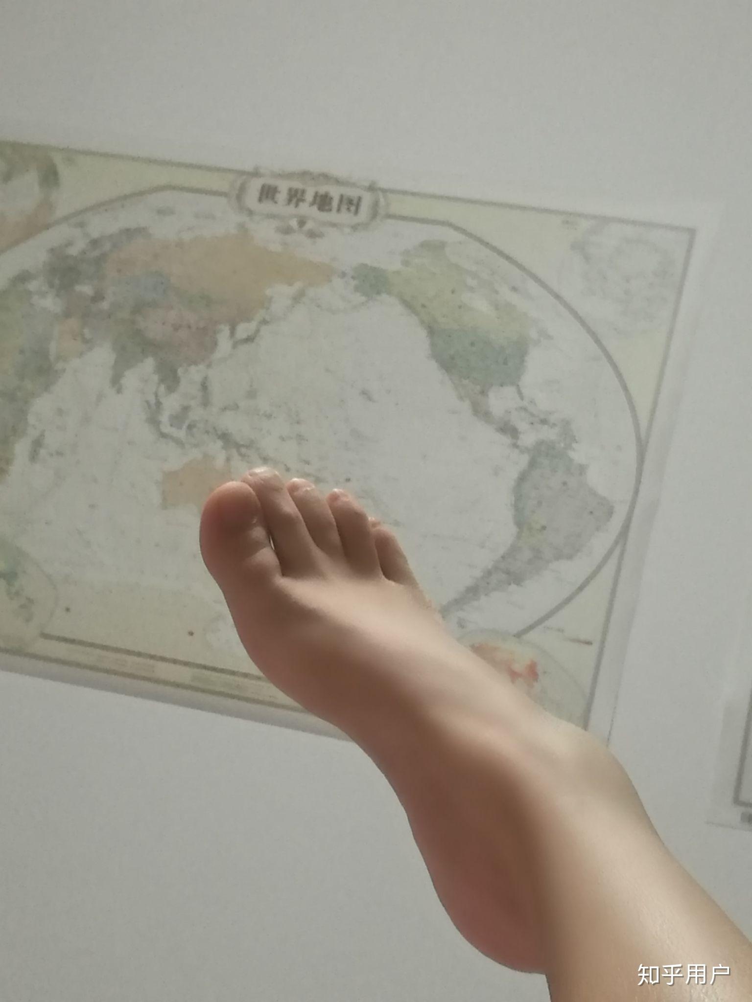 希腊脚脚掌图片