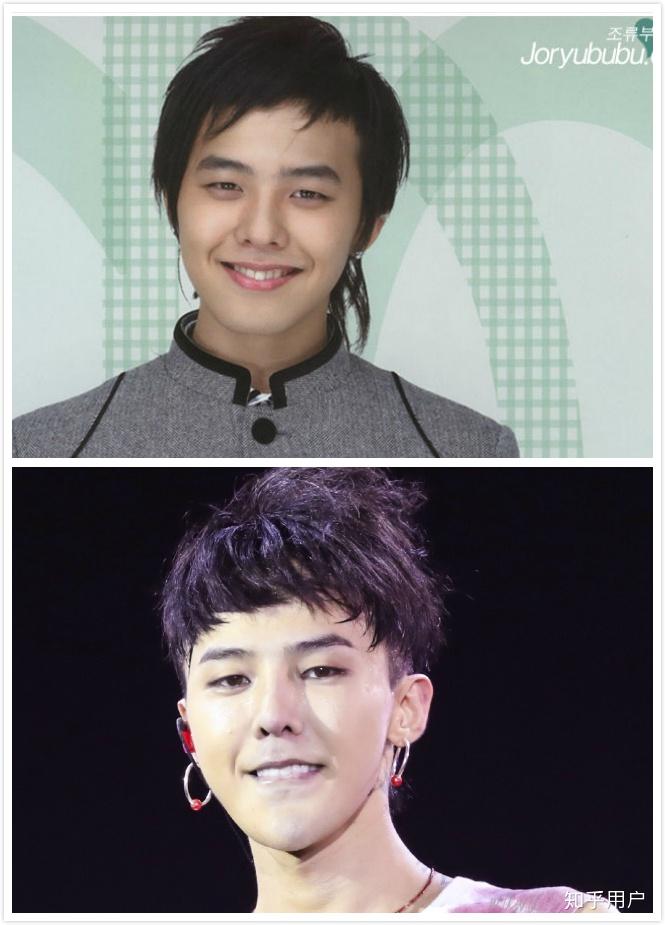 权志龙哪一年开始整下巴