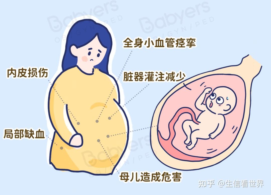 cffDNA与子痫前期 - 知乎