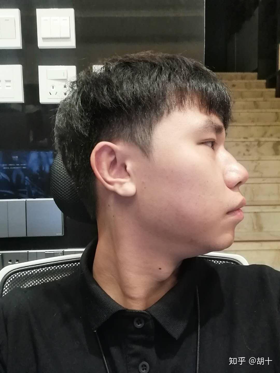 正脸正常侧脸丑到爆是什么体验