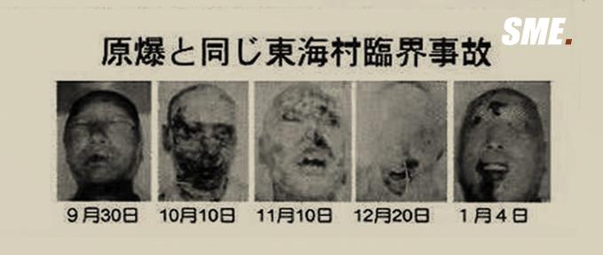 日本最痛苦的死亡 东海村核临界事故 每日头条