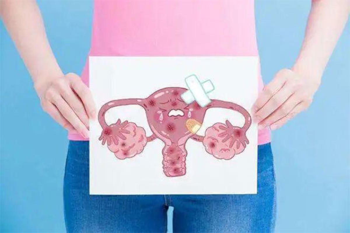 少有人说的附件炎,99%女性都不知道,附件炎会对女性的身体造成什么危害?一文了解清楚! - 知乎