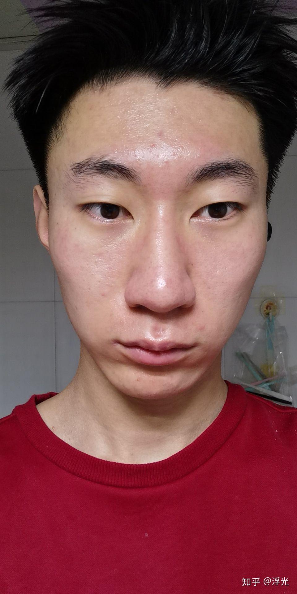 厚嘴唇塌鼻子单眼皮的男生还有救吗