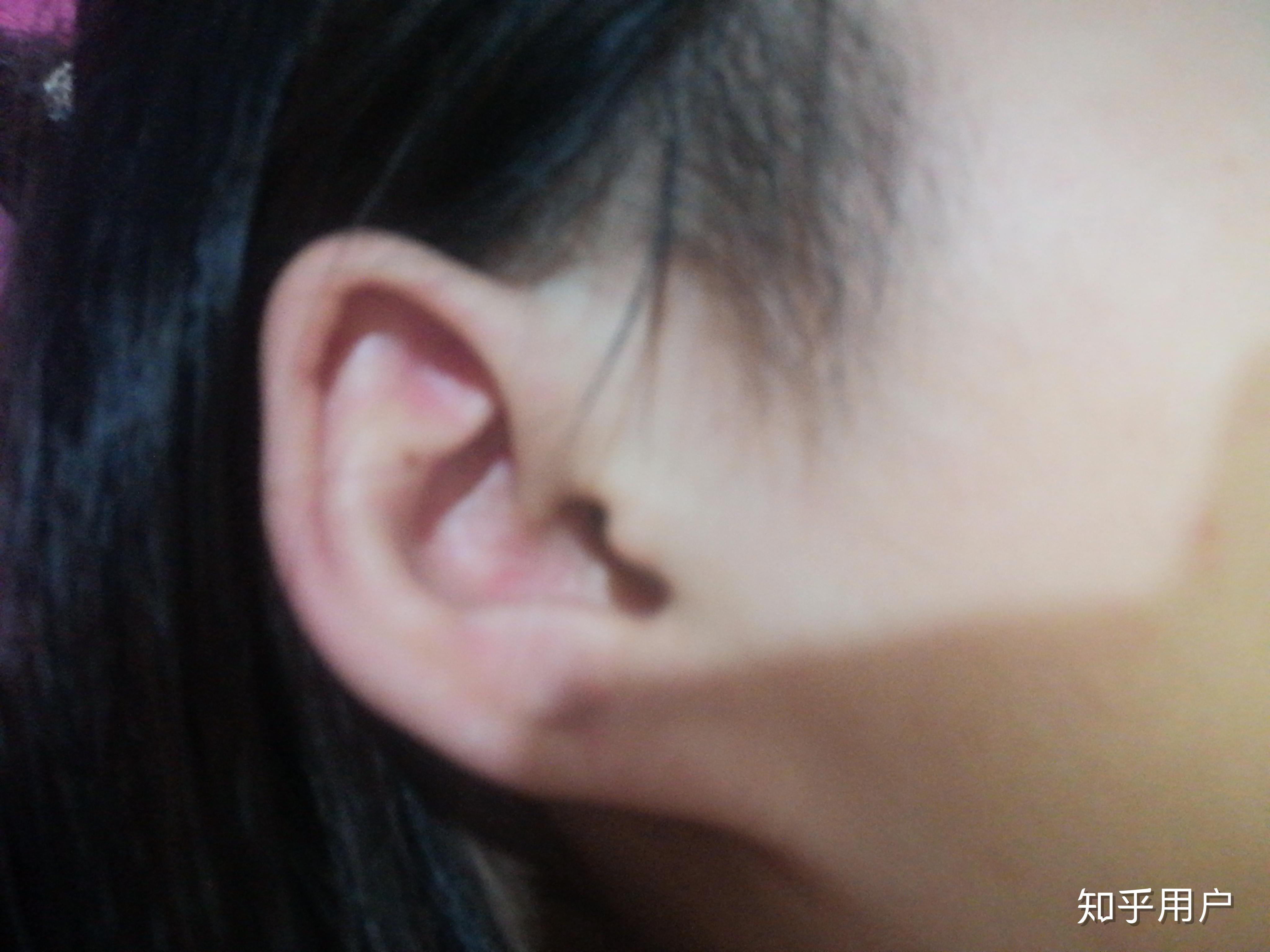 耳朵上端是尖的像精灵一样,是反古现象吗? - 知乎