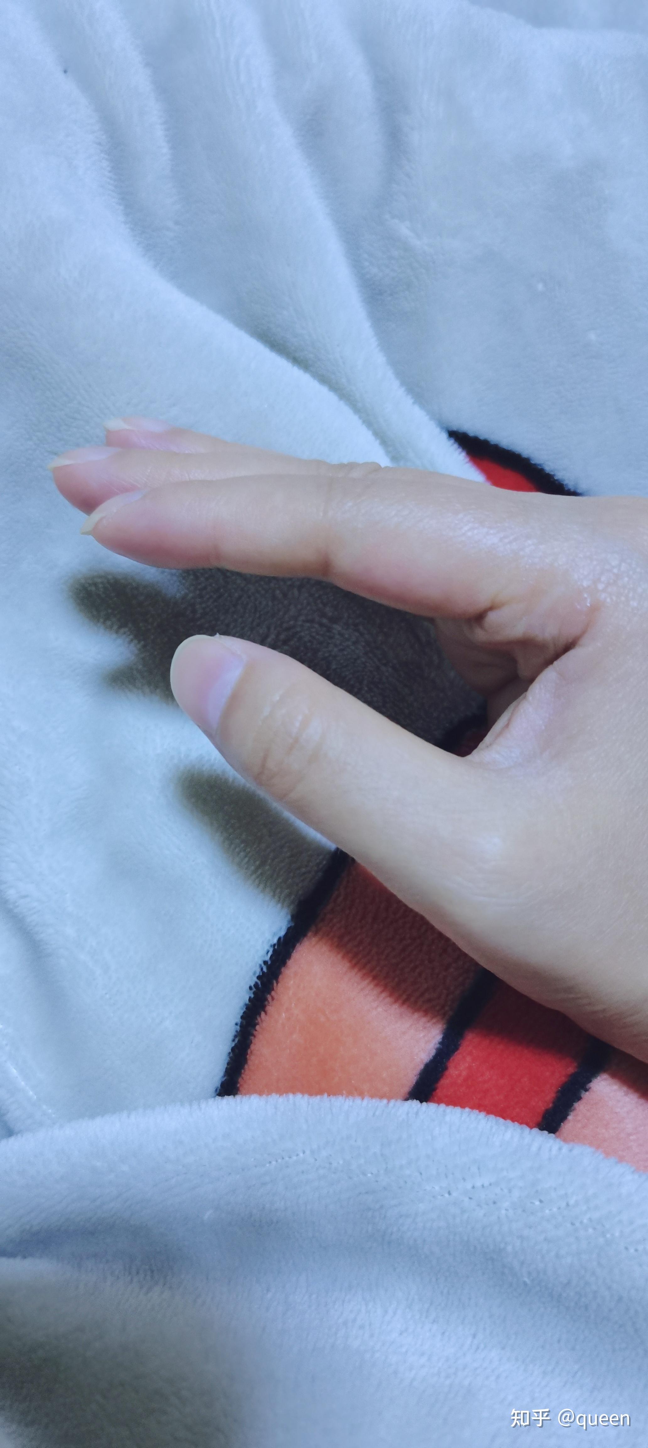 为什么食指的指甲向下生长? - 知乎