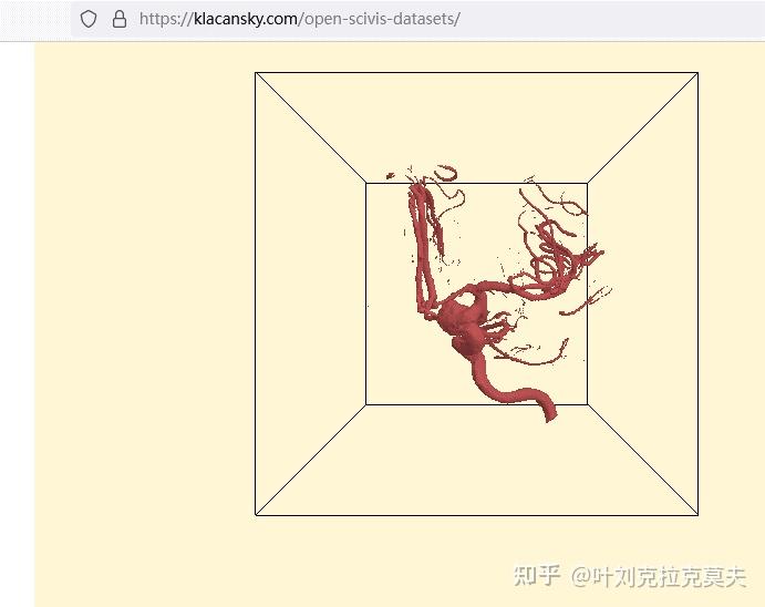 Opengl Ct 用Python和OpenGL探索数据可视化(实践篇)- CT扫描体数据可视化 - 知乎