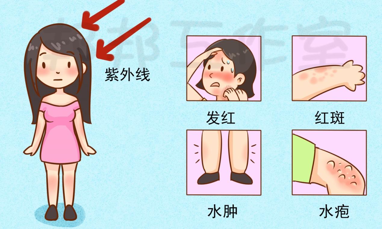 为什么会有紫外线过敏,紫外线过敏如何治疗? - 知乎