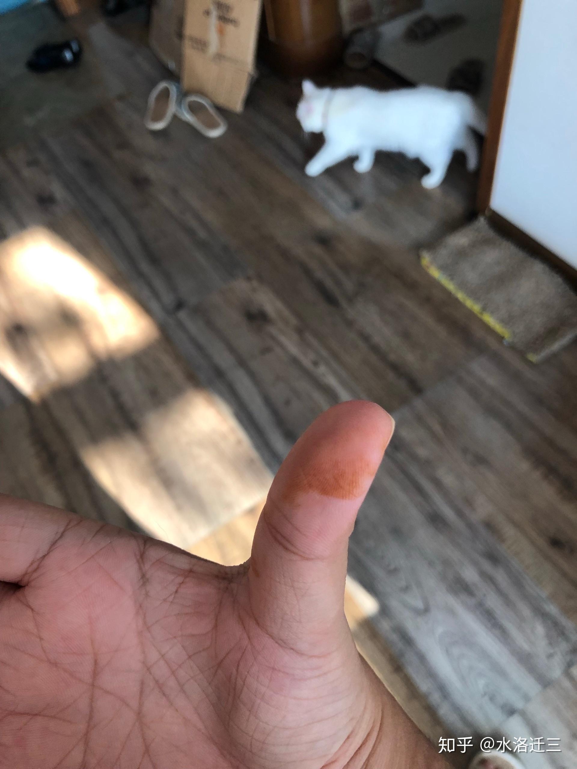 一觉醒来手上有铁锈一般的黄色块洗不掉