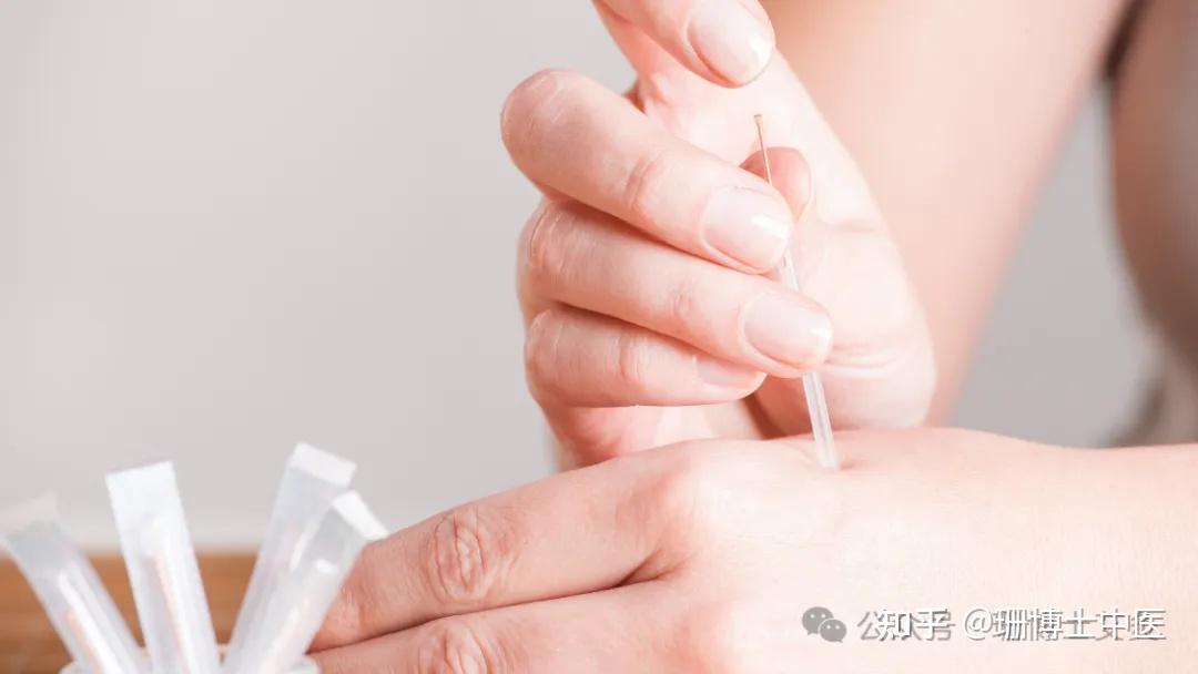 解码针灸治疗原理：气血阴阳、脏腑全息等多维度解读 - 知乎