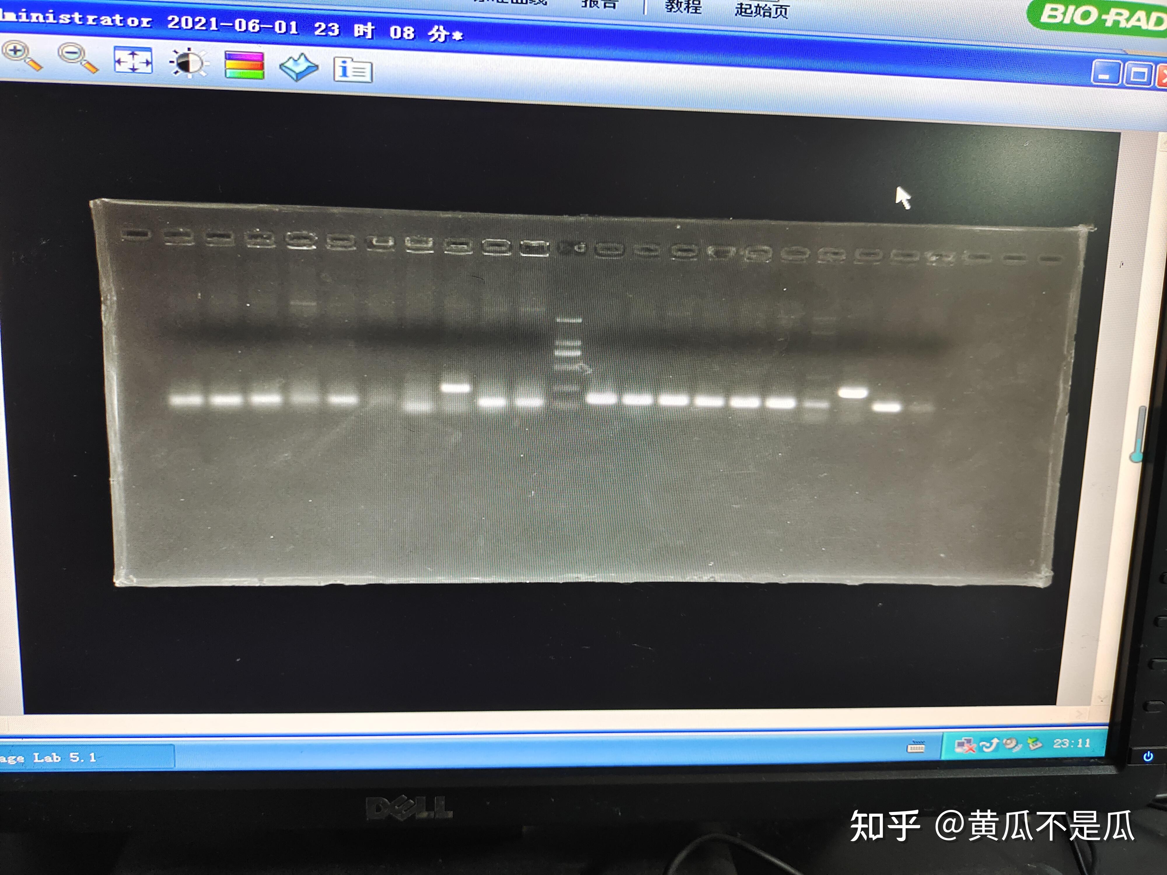 PCR胶回收后,测完浓度和跑胶,进行菌落PCR没有目的条带 - 知乎