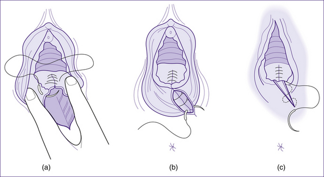 繁衍是物种生存的本能,但生育过程却令母体非常痛苦,这是否违背进化
