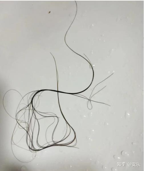 很多医学生说,脱发了一定要用含有侧伯叶的洗发水,真的吗?
