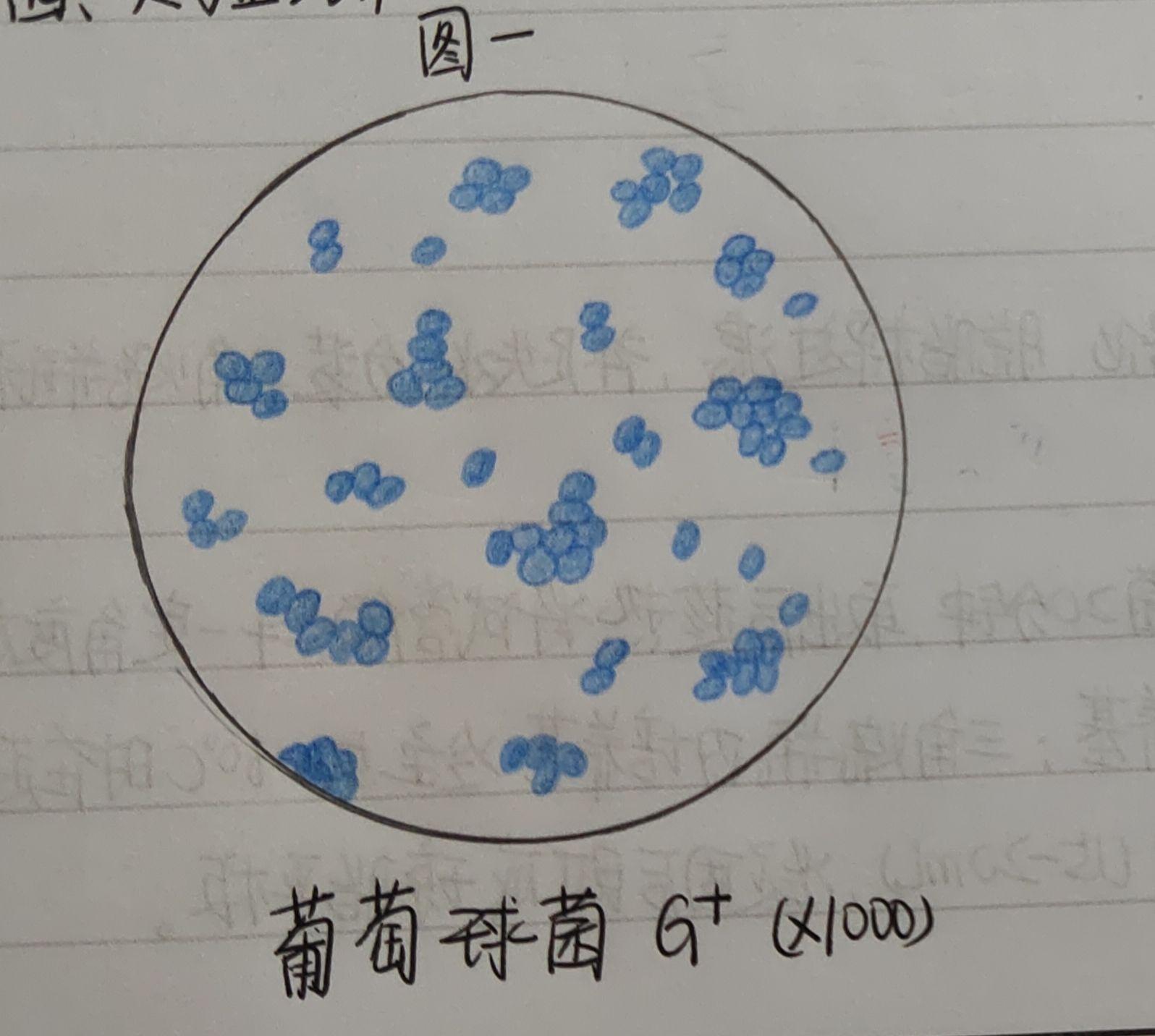 结核杆菌,大肠杆菌,蜡样芽孢杆菌,炭疽杆菌的红蓝铅笔手绘图吗?