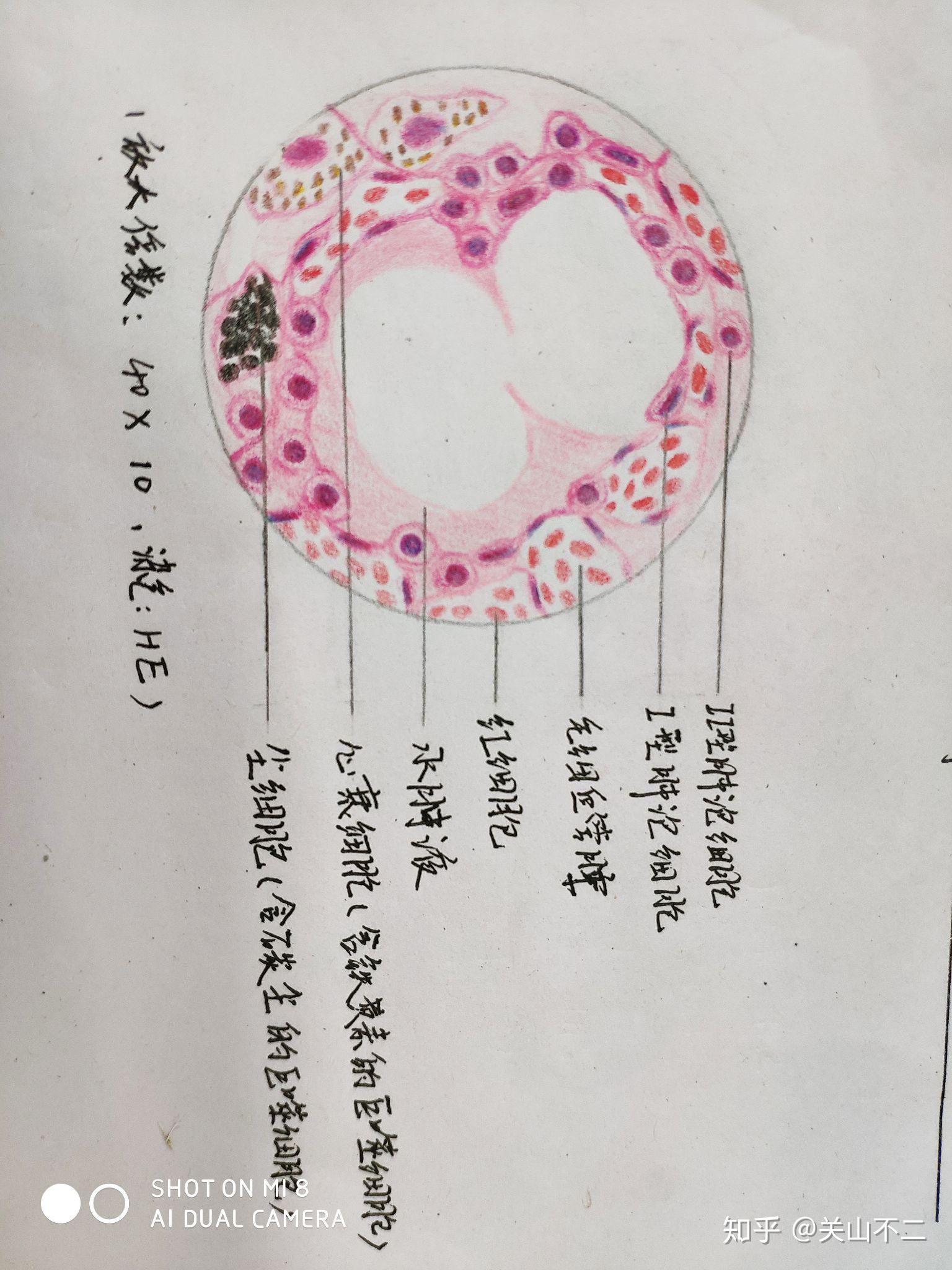 请问大家谁能教我画画肺淤血的病理实验报告图,我参考一下,在这谢过了