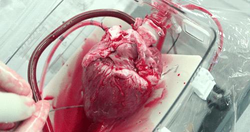 不同角度为你呈现真实心脏跳动