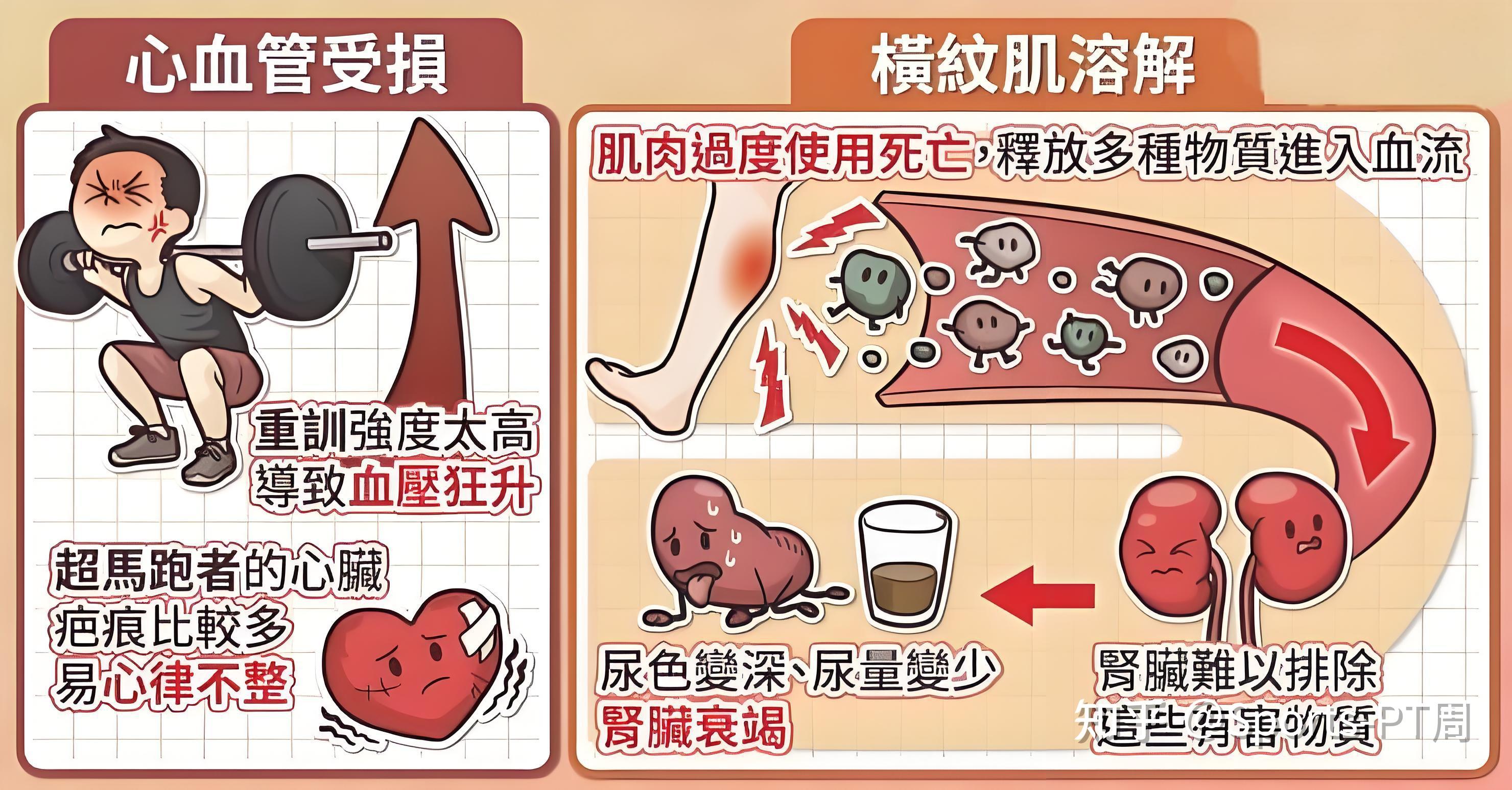 为什么深蹲会导致横纹肌溶解症?