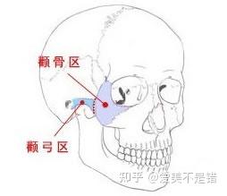 何晋龙解读：颧弓在哪里? - 知乎