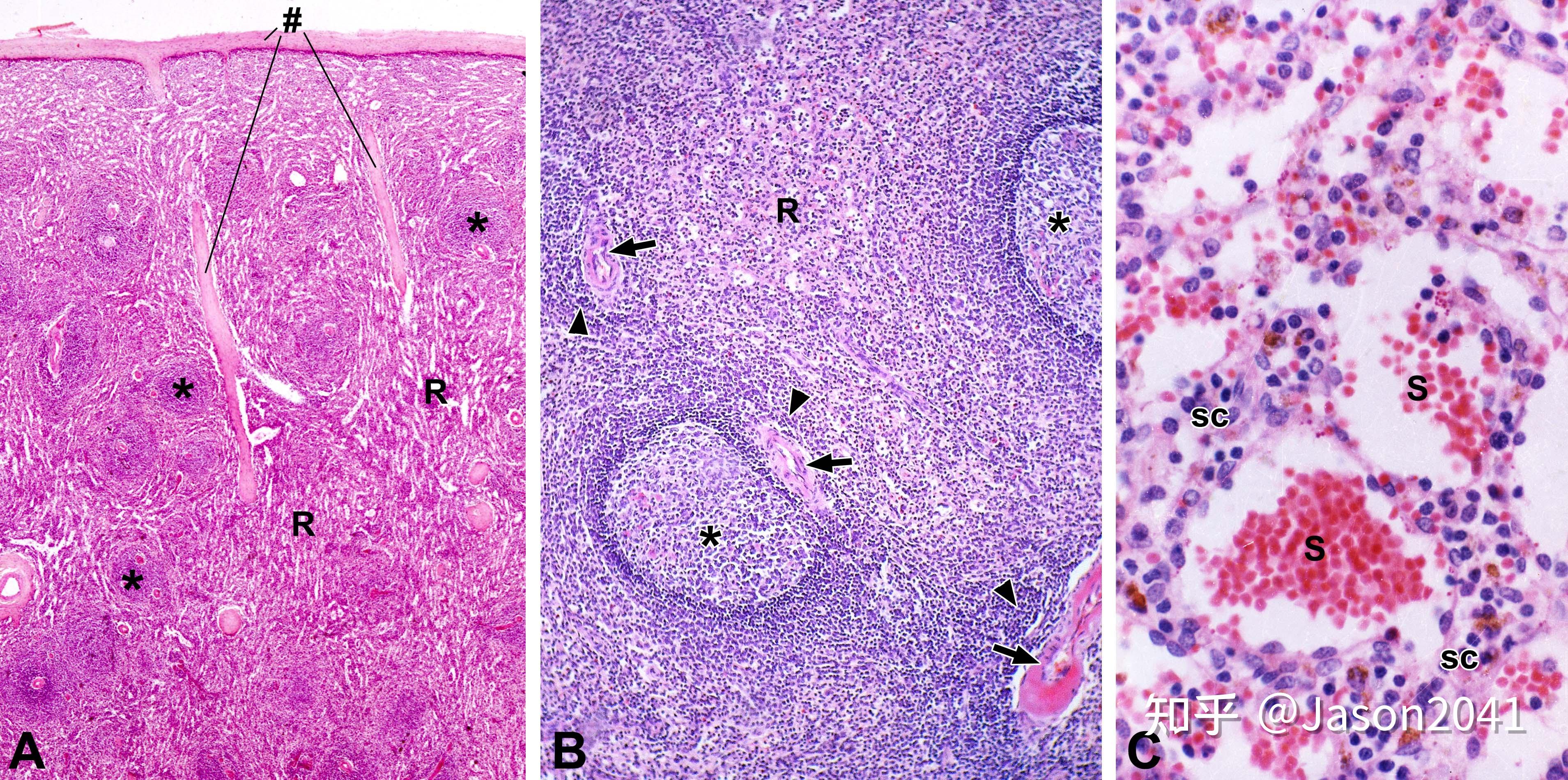 脾的组织结构 - 知乎