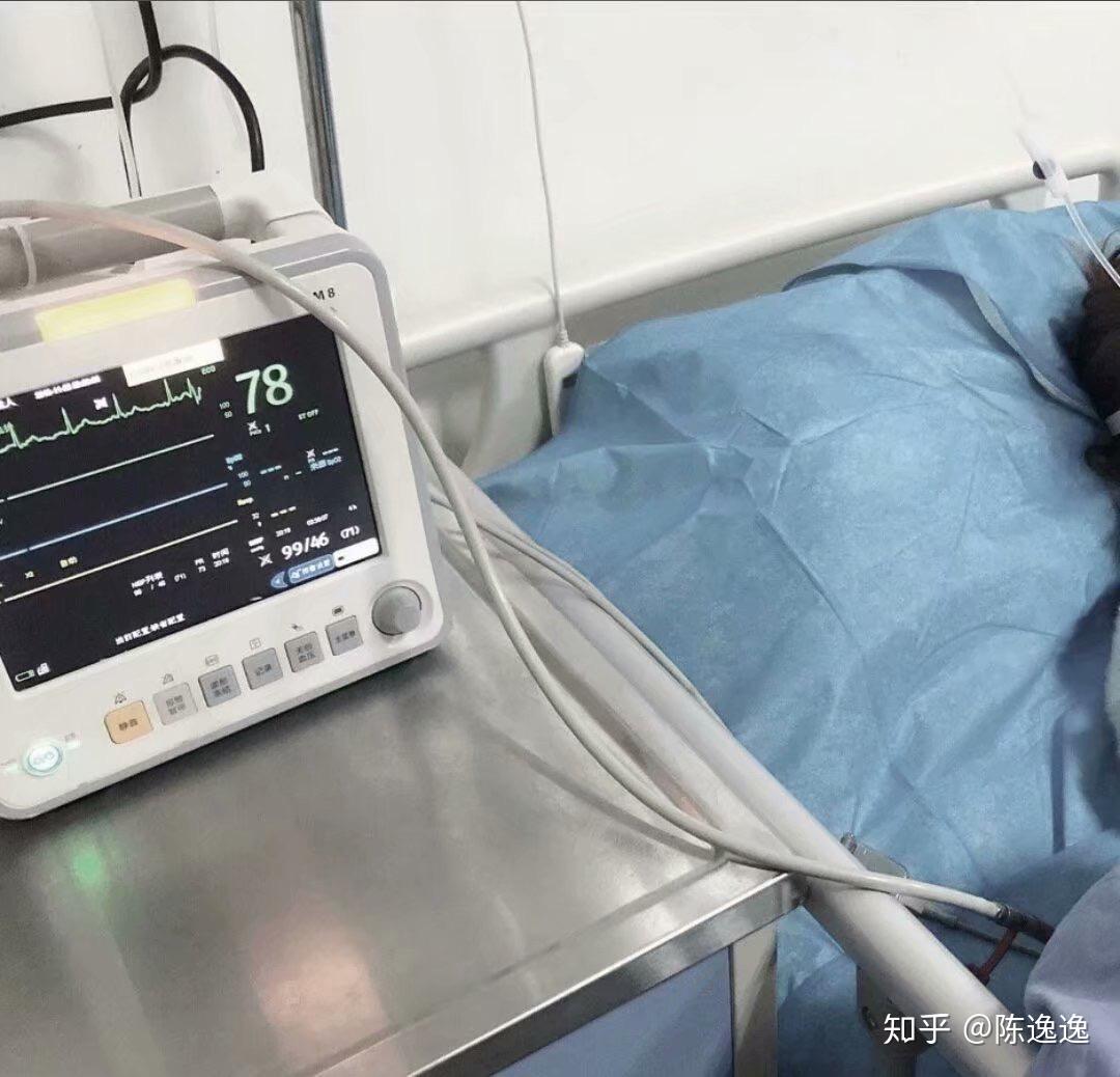 接受mect无抽搐电休克治疗是怎样的一种体验