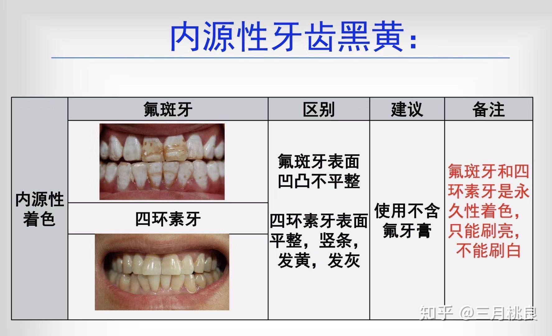 牙齿发黑用什么变白? - 知乎