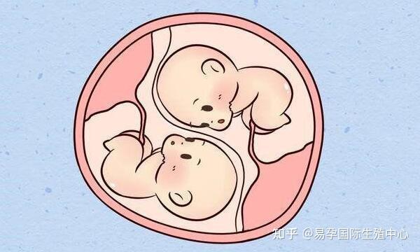 易孕国际生殖医学——试管单胎和双胎由什么决定 - 知乎