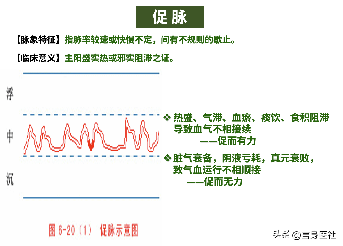 中医故事:促脉、结脉、代脉、弦脉和紧脉的合集 - 知乎