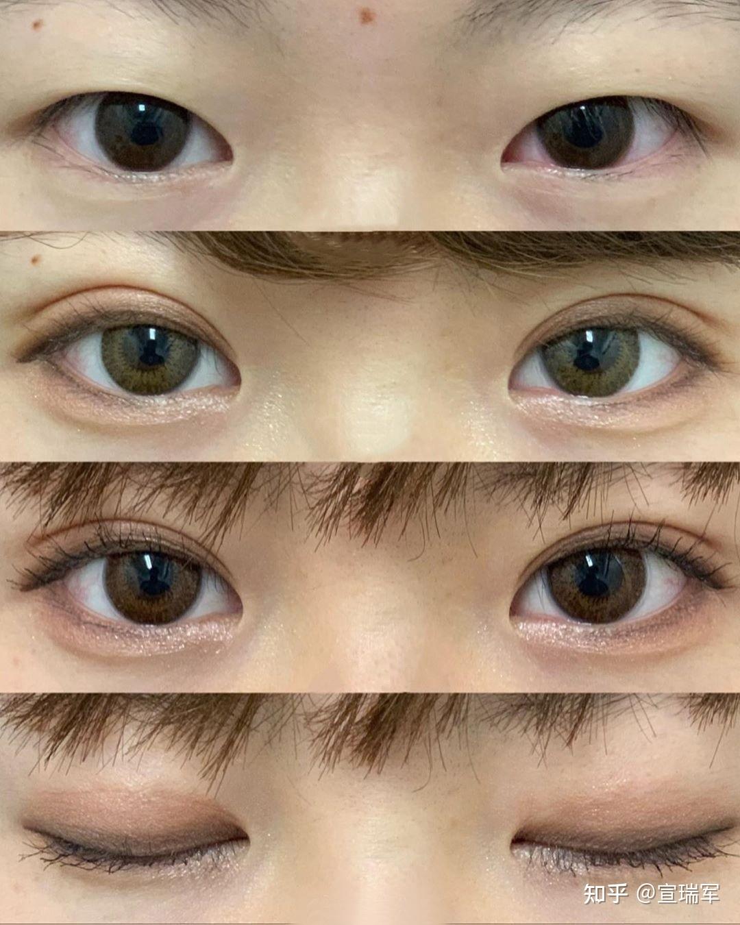 肿眼泡,内双,眼睛怎么变成大眼睛,变双眼皮? - 知乎
