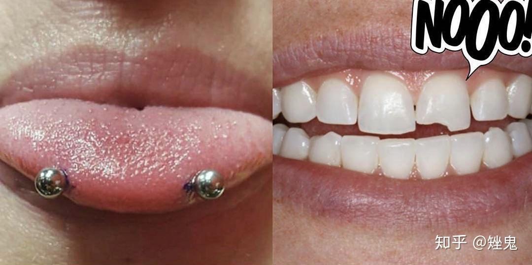 视频图片搬运-Snake Eyes Piercing舌尖钉 - 知乎