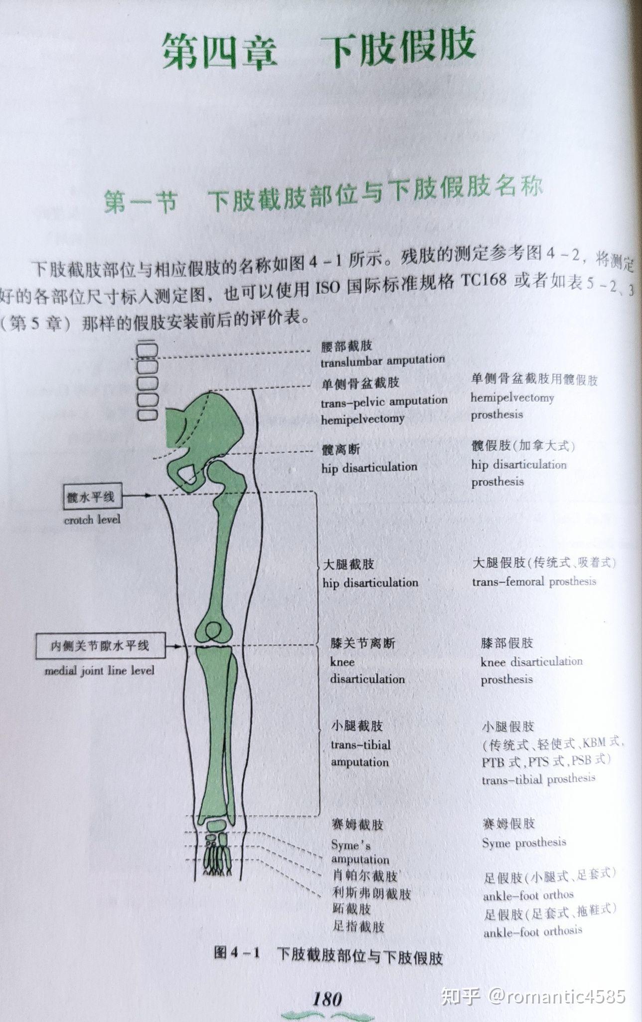 大腿假肢接受腔种类图片