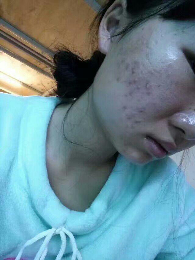 皮肤的好坏对颜值的改变有多大