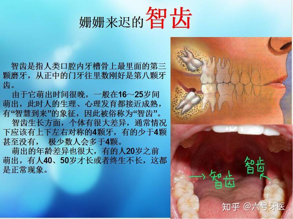 智齿到底是几岁长才正常