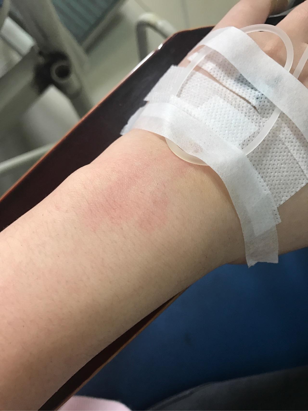 为什么静脉注射阿奇霉素对血管刺激这么严重