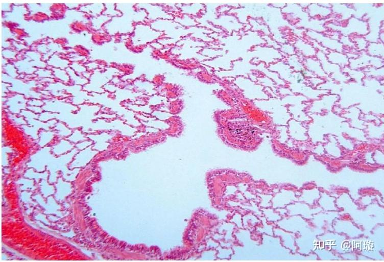细支气管和终末细支气管在光镜下如何区别