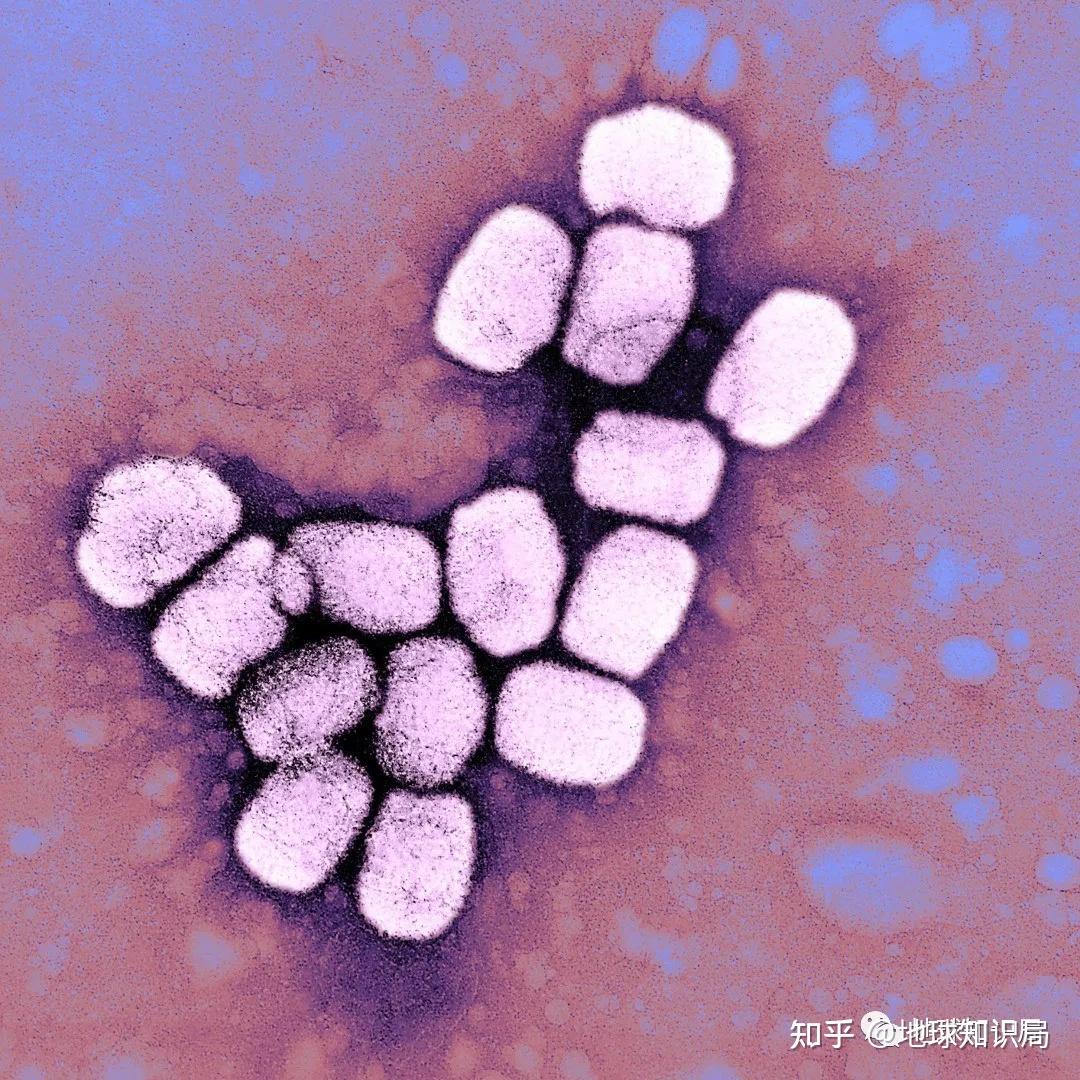「天花」是一种怎样的传染病? - 知乎