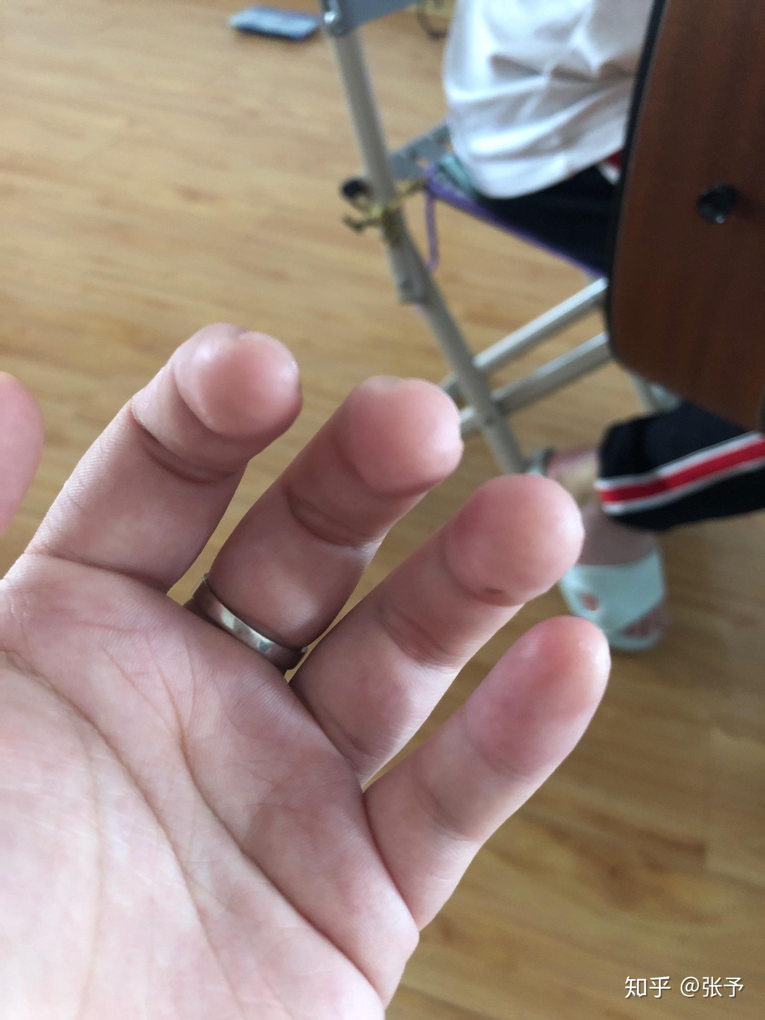 大家弹吉他的手指都是什么样的