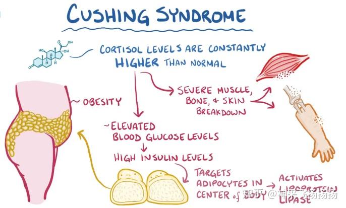 医学科普之库欣综合征Cushing Syndrome - 知乎