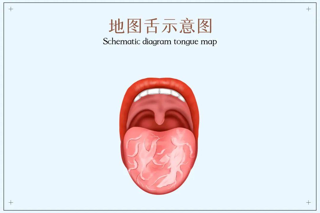 健不健康看舌头就知道?舌头出现这7种现象,可能是身体发出疾病预警 - 知乎