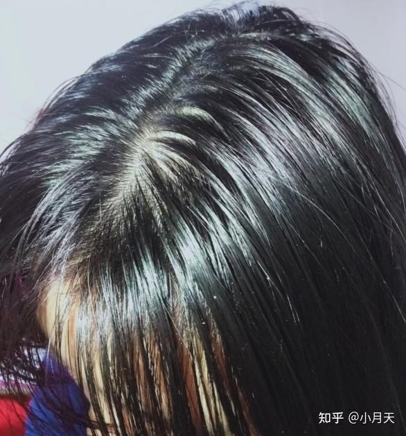 哪款洗发水能够改善头顶头发扁塌? - 知乎