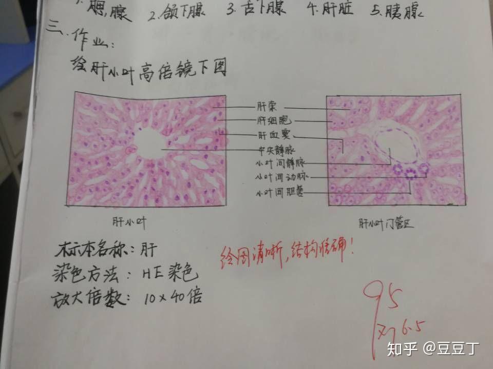 高倍鏡下肝小葉和門管區紅藍鉛筆手繪圖