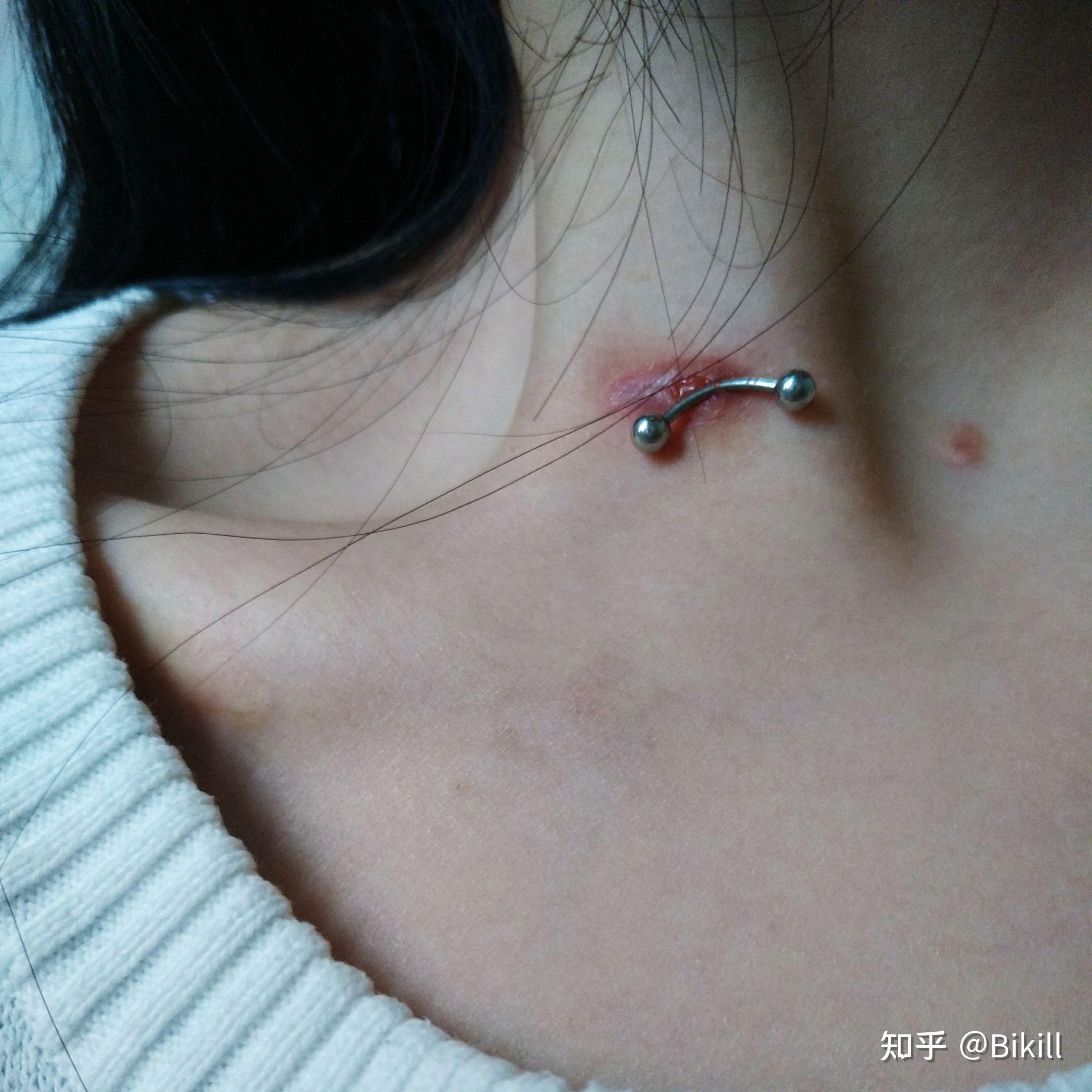 我想看看唇钉摘下后是什么样子的? - 知乎