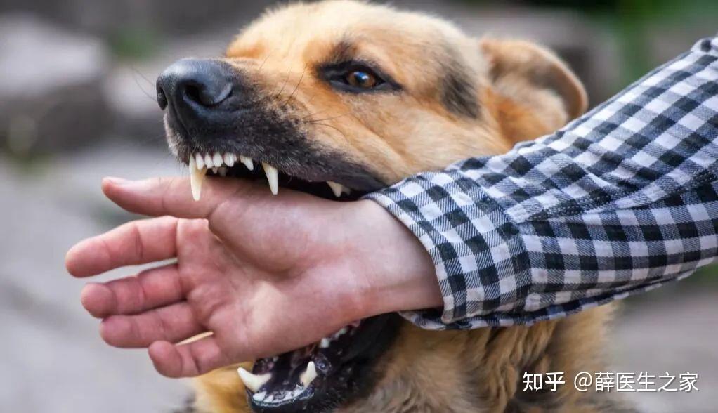 夏季儿童小心猫猫狗狗,被抓伤一定及时处理,不然危及生命 - 知乎