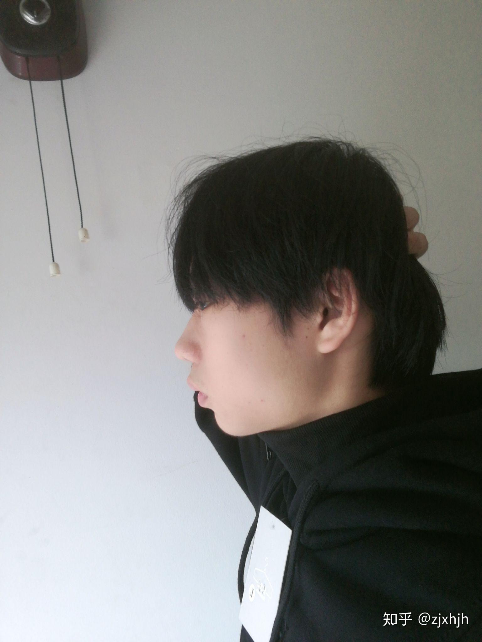 头型小时候被家长故意睡成扁头怎么办? - 知乎