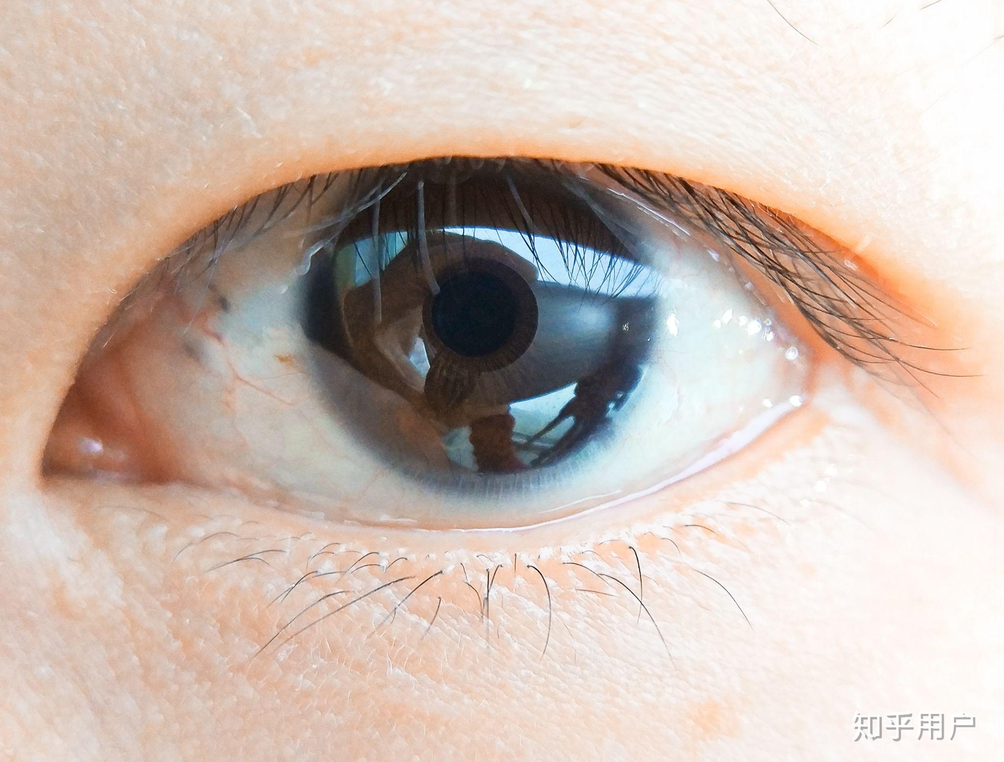 颜色不一样,好像波斯猫… 但又没有那种很鲜明的颜色,是虹膜异色吗?