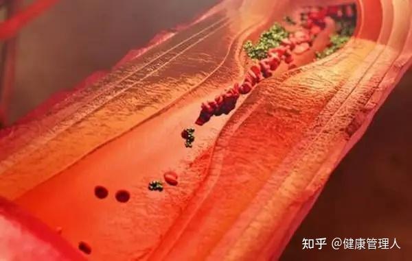 常吃三食物，血管通到底，血栓从此不找你 - 知乎
