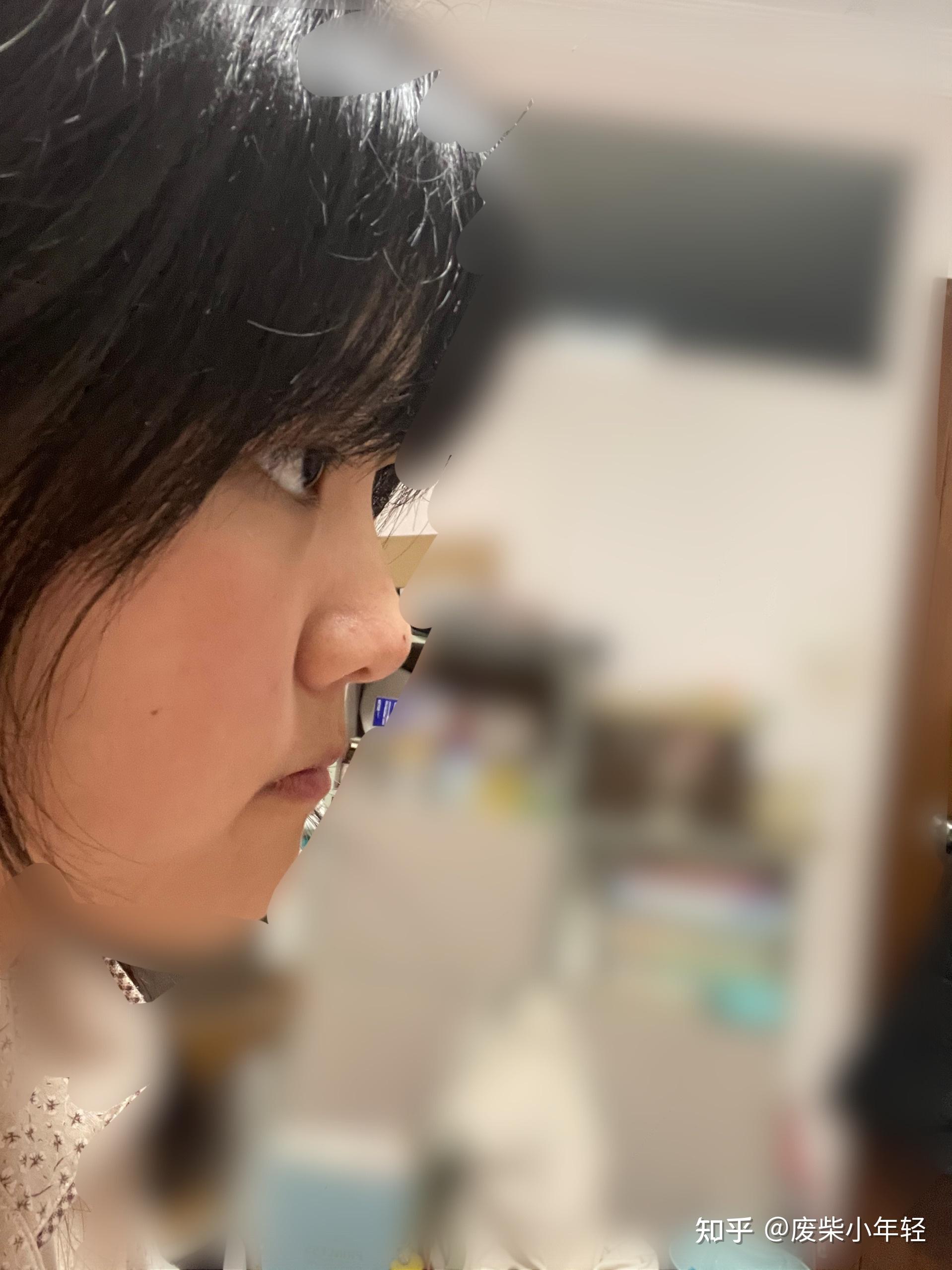 有一个超级扁平的侧脸是一种什么样的体验? - 知乎