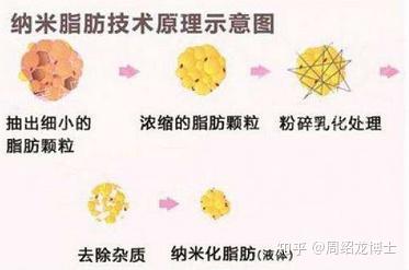 普通脂肪、纳米脂肪、SVF-GEL脂肪胶区别在哪？ - 知乎