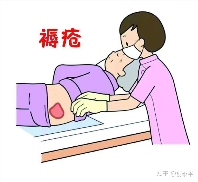 压疮(褥疮)的特点、分类及危害 - 知乎