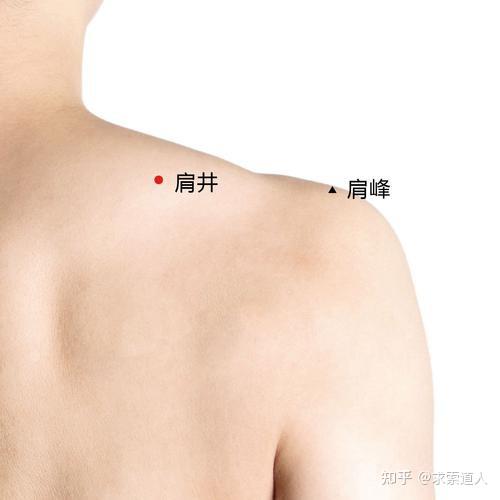 为什么肩颈部位要常刮痧
